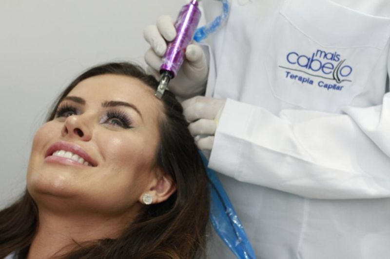 Desvendando mitos: o sucesso do transplante capilar em Manaus