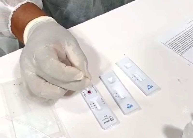 SAÚDE/FVS-RCP realiza mais 432 testes rápidos para diagnósticos de Infecções Sexualmente Transmissíveis
