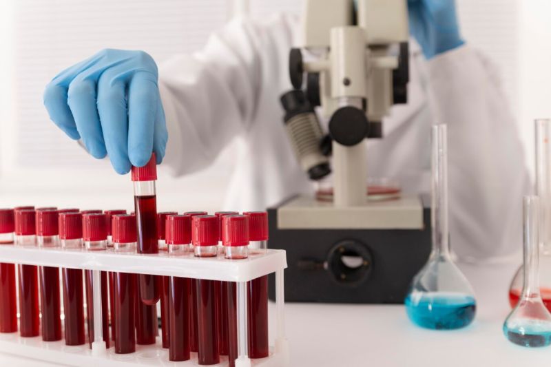 SAÚDE/EXAMES de análises clínicas auxiliam o diagnóstico de doenças AUTOIMUNES