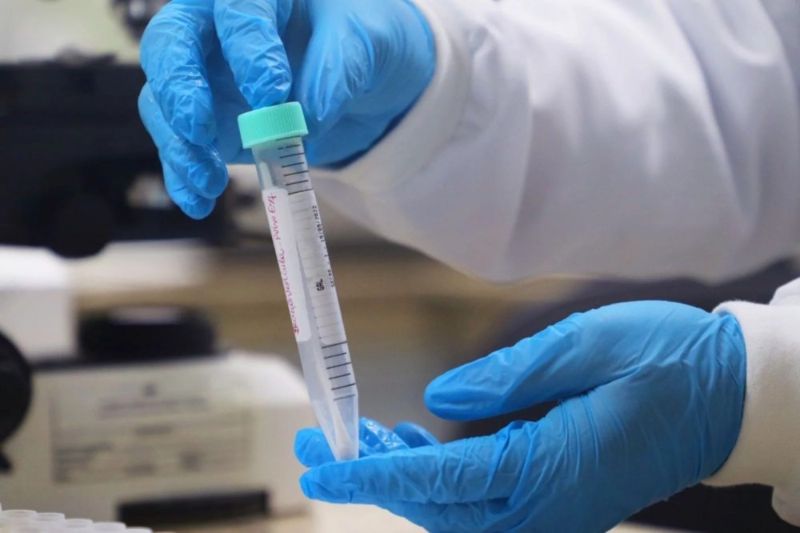 CIDADE/MPOX: 21 casos são confirmados no AMAZONAS desde o início do ano