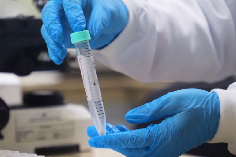 SAÚDE/AM tem 24 casos confirmados de MPOX em 2025, segundo dados da FVS