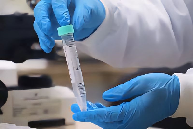 SAÚDE/FVS-RCP registra redução de casos de MPOX no Amazonas