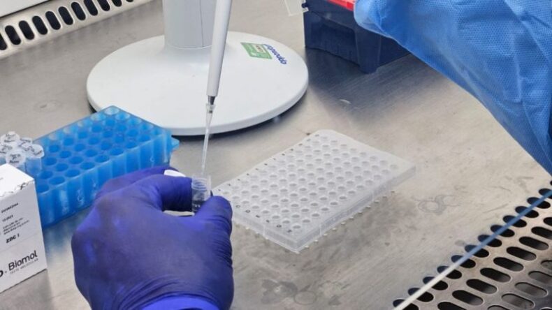 CIDADE/Amazonas tem REDUÇÃO de casos e óbitos no informe de SRAG