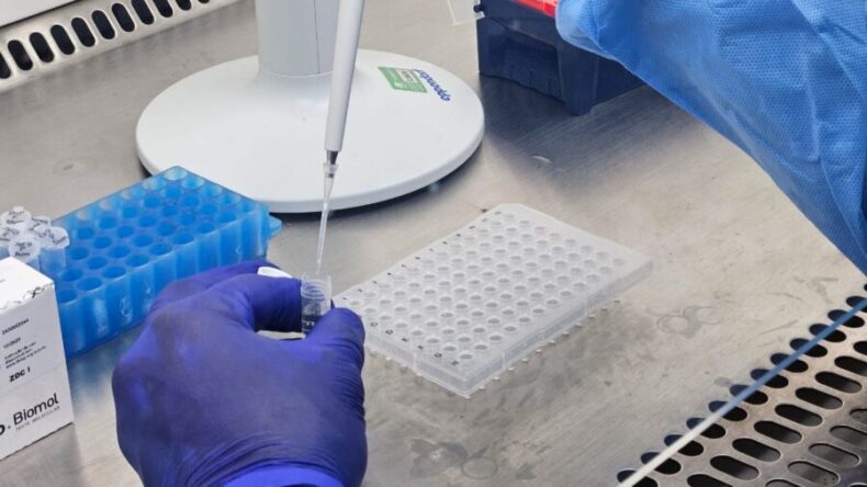 SAÚdE/FVS apresenta atualização sobre Vírus Respiratórios no Amazonas